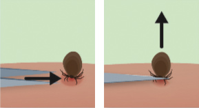 Facts About Ticks And Lyme Disease Wilderness Scotland Facts About Ticks And Lyme Disease Wilderness Scotland